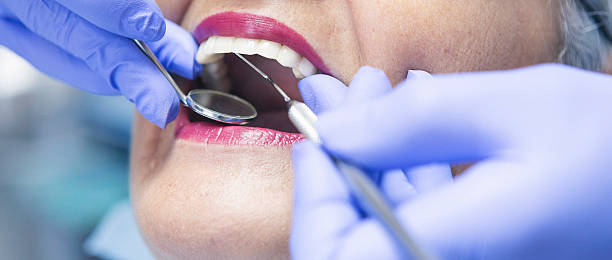 Best Emergency Root Canal Treatment in Kirkland, WA