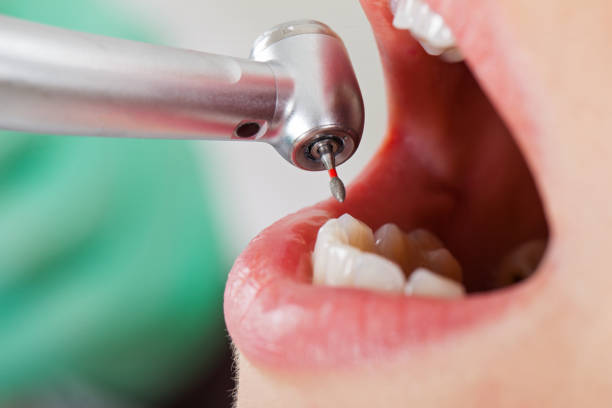 Best Emergency Cosmetic Dentistry in Kirkland, WA